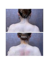 ラポール/背中・お腹のトリートメント