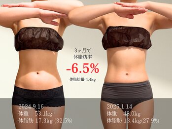 マルノウチ サロン(MARUNOUCHI salon)/施術1回ビフォーアフター