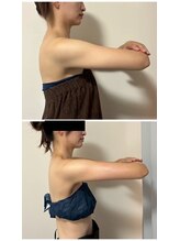 ルナグランデ 心斎橋店(Luna grande.)/痩せにくい脂肪も撃退