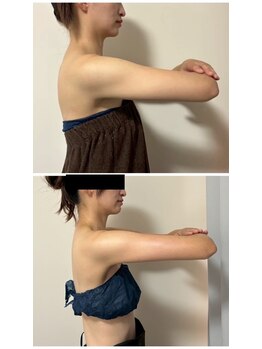 ルナグランデ 心斎橋店(Luna grande.)/痩せにくい脂肪も撃退