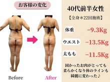 ベルホワイト(Belle White)/【40代前半/3ヶ月の変化】