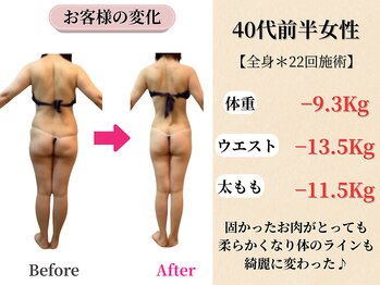 ベルホワイト(Belle White)/【40代前半/3ヶ月の変化】