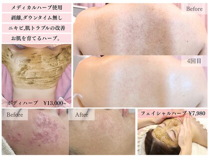 レヴェリー 心斎橋店(REVERIE)の写真