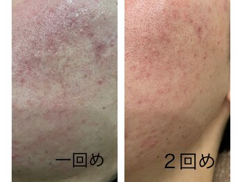 ビキャット(Be cat)/VOSサロンケア　ブラック