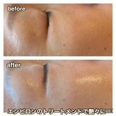 プライベートサロン サイ(sai)