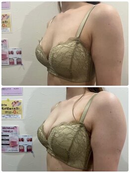 サンク アール(CinQ-R. 美九)/バストアップメゾット