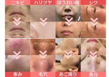 エステティック レイビス 川崎店(RAYVIS)