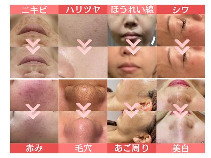 エステティック レイビス 川崎店(RAYVIS)の写真