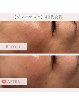 エクラ アン(eclat.un)/ゾンビマスク 40代女性