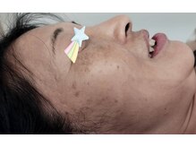 麻謝/【使用前】Dr.PUR BEAUTE化粧品