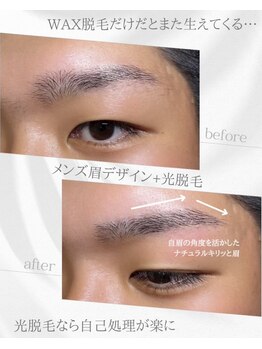リノア(Linoa)/メンズ眉毛ビフォーアフター