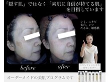 アトレ