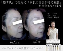 アトレ