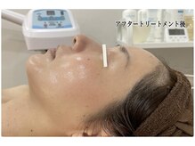 グリーンピールサロンリーフ(Leaf)の雰囲気（類似ハーブピーリングと明らかに違うGREEN PEELの魅力を伝えたい）