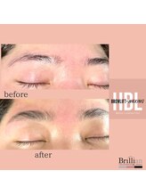 ブリリアン/ハリウッドブロウリフト