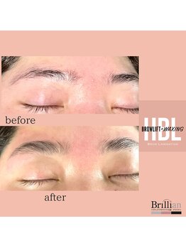 ブリリアン/ハリウッドブロウリフト