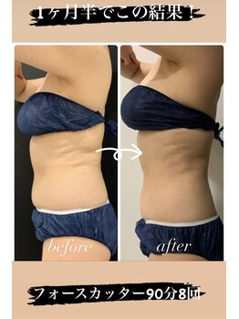 スパチャーレ(Spa ciare)/フォースカッター