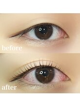 ボアップ(boappu)/まつ毛パーマ