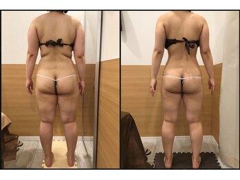 リッツ 草加店(Ritz)/【Before/After】　痩身