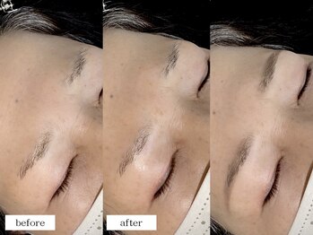 エムドット(m.)/アイブロウワックス脱毛