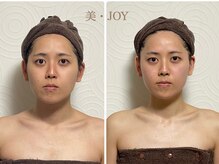 美 ジョイ(美 JOY)/小顔コルギ　施術例
