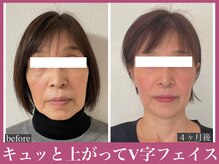 アクアビー(AQUA-B)/