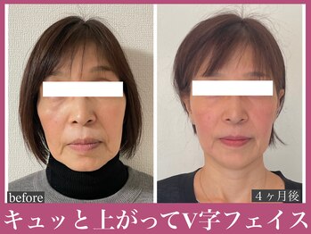 アクアビー(AQUA-B)/