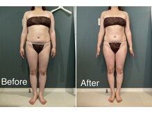 サンニロク(326)/４０代のお客さま/８回施術