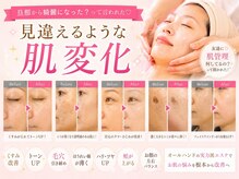 イーズ(ease)