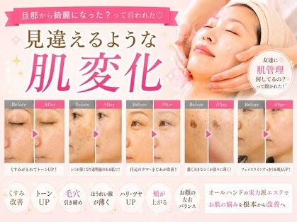 イーズ(ease)の写真