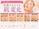 イーズ(ease)の写真
