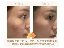 リボーン(REBORN)の雰囲気(あなたの「変わりたい」を全力でサポートさせて頂きます!)