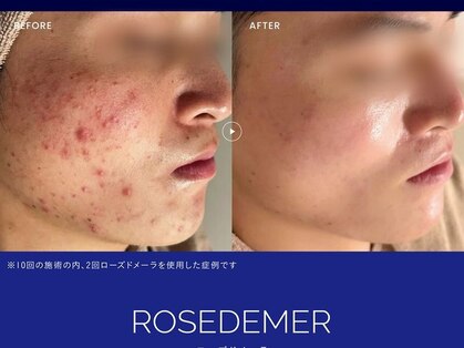 カズキ ハギワラ(Kazuki Hagiwara)の写真
