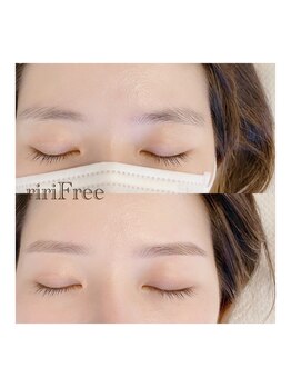 リリフリー(riri Free)/