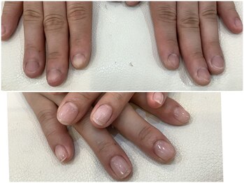 シャンネイルケアサロン(Shan Nail caresalon)/深爪さん