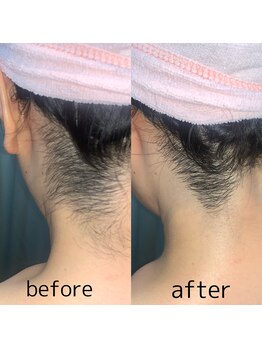 ビューティフェイス ビューティアイラッシュ 岡山天満屋店(BeautyFace Beautyeyelash)/卒業式前に【岡山】