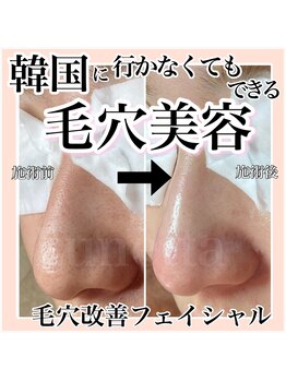 ルネッタ(Lunetta)/