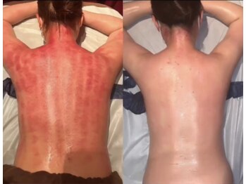 マーズ(Mars)/脂肪セル撃退