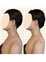 ルマ(Rumah)/首の後ろの盛り上がりがスッキリ