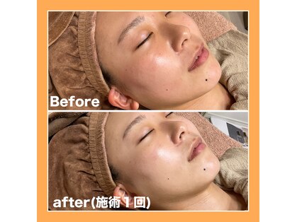 アンドナップ(nap)の写真