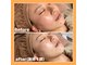 アンドナップ(nap)の写真