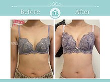 美人バスト 表参道店/【バストアップ/育乳☆症例】