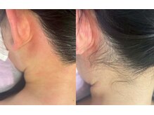 ティンク(Tink)/うなじワックス☆Before→After