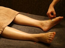 カリスタ 広島店(CALISTA)/お灸でじんわり温める