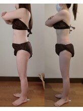 フランジパニ(Frangipani)/お腹キャビ×吸引×強力ハンド