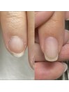 左before/右after約1年