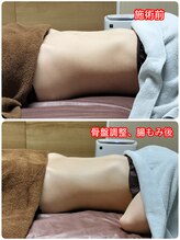 シャルールプラス(chaleurplus)/痩せたい方に！