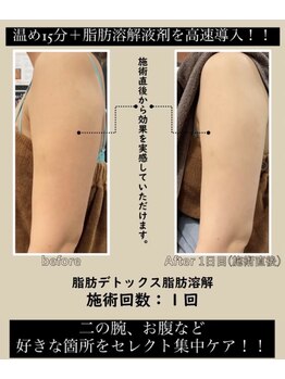 リセラージュ(Recellage)/