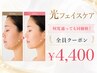 【全員】何回通っても同価格◎大人気メニューを安価で♪光フェイスケア￥4,400