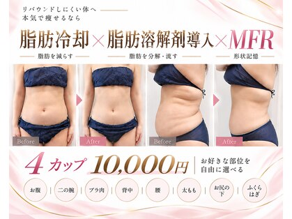 プレミドールの写真